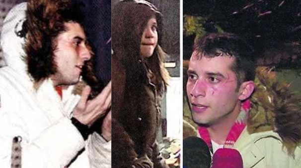 Oyuncu Fırat Altunmeşe sevgilisinin saldırısına uğradı
