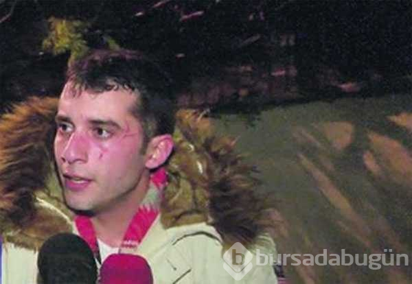 Oyuncu Fırat Altunmeşe sevgilisinin saldırısına uğradı
