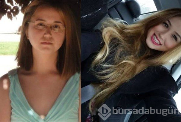 Ergenlik sonrası böyle değiştiler
