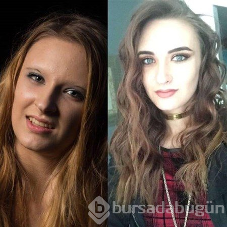 Ergenlik sonrası böyle değiştiler

