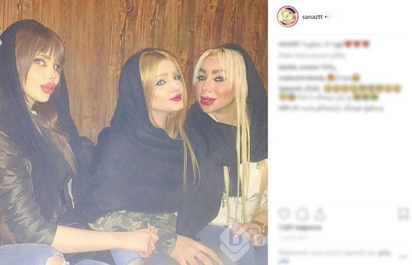 İran'ın 'estetikli kadınları'

