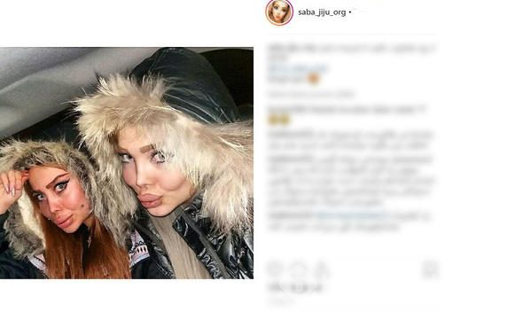 İran'ın 'estetikli kadınları'

