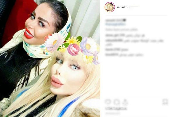 İran'ın 'estetikli kadınları'

