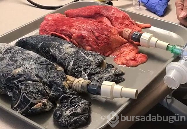 Tiryakilere müjde! 20 günde bıraktırıyor