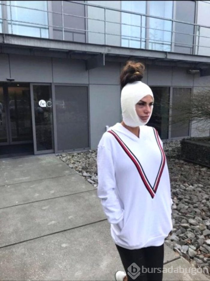 Yüz Gerdimre Operasyonu Sırasında Fotoğrafı Çekilmiş Ünlü Şarkıcı