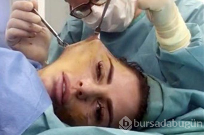 Yüz Gerdimre Operasyonu Sırasında Fotoğrafı Çekilmiş Ünlü Şarkıcı