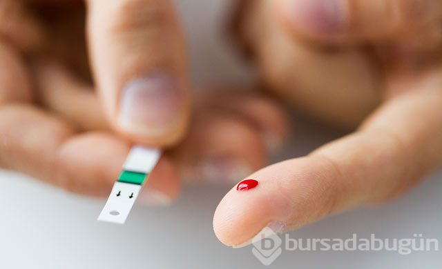 Yeşil muzun bilinmeyen faydaları
