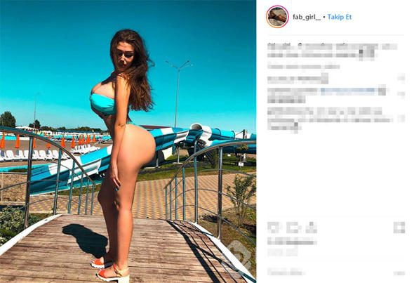 Bana 'estetikli' diyene dava açarım