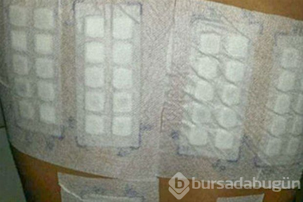 Birçok şeye alerjisi var
