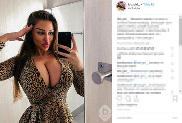 `Bana `estetikli` diyene dava açarım`
