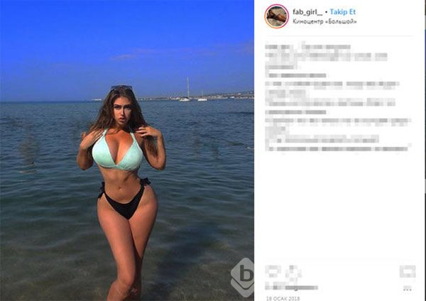 `Bana `estetikli` diyene dava açarım`
