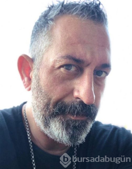 Cem Yılmaz'ın gözüne ne oldu?
