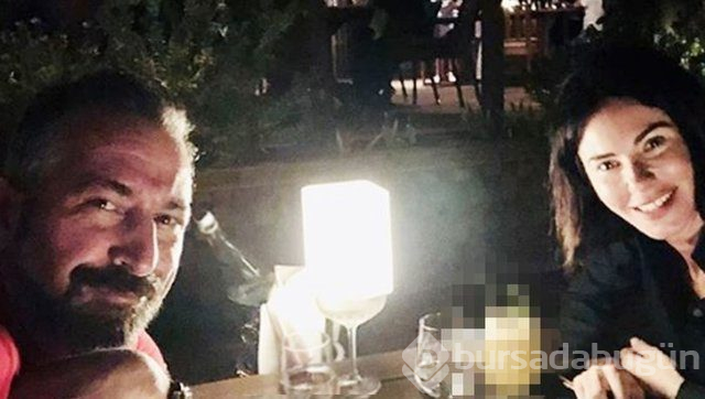 Cem Yılmaz'ın gözüne ne oldu?
