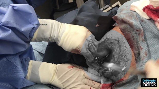 Boynundan çıkan şey şoke etti!