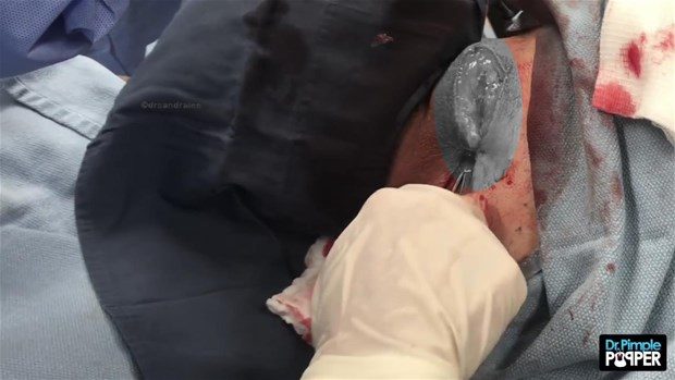 Boynundan çıkan şey şoke etti!