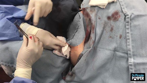 Boynundan çıkan şey şoke etti!
