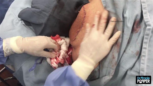 Boynundan çıkan şey şoke etti!