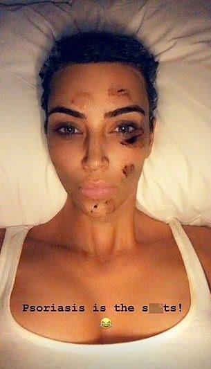  Kim Kardashian'ın ilginç cilt tedavisi 