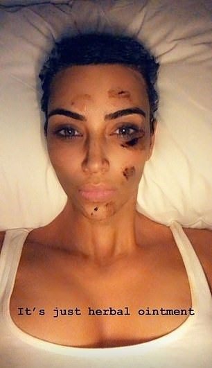  Kim Kardashian'ın ilginç cilt tedavisi 