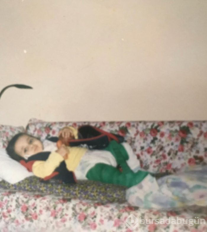 ''Cam Kız''ı iyileştiren yollar
