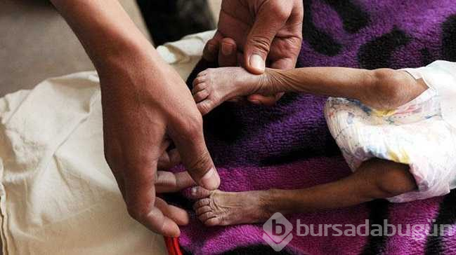 Yemen'deki savaş insanlık dramına dönüştü
