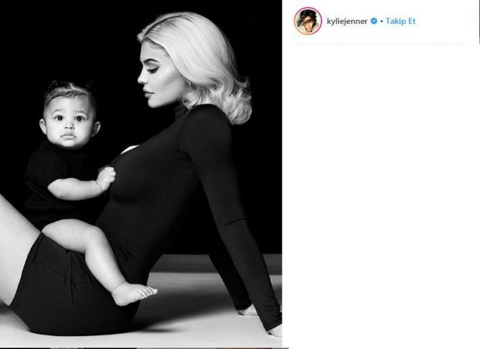 Kylie Jenner estetik iddialarını yalanladı
