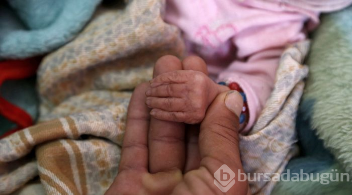 Yemen'de kıtlık en çok çocukları etkiliyor
