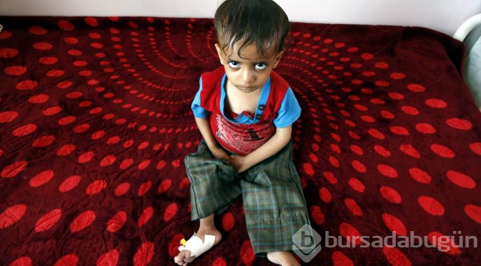 Yemen'de kıtlık en çok çocukları etkiliyor
