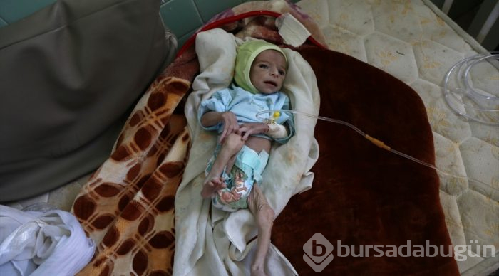 Yemen'de kıtlık en çok çocukları etkiliyor
