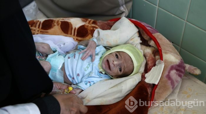 Yemen'de kıtlık en çok çocukları etkiliyor
