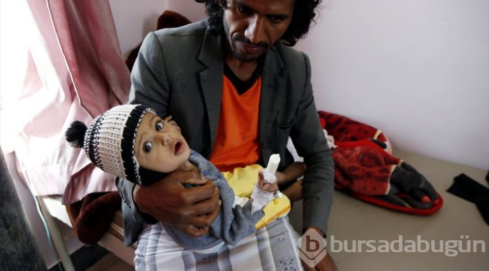 Yemen'de kıtlık en çok çocukları etkiliyor
