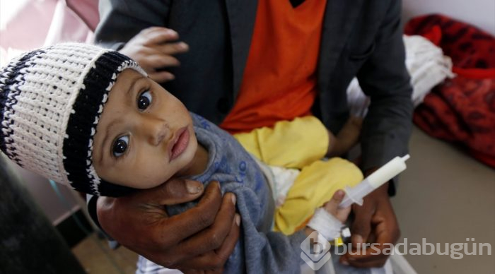 Yemen'de kıtlık en çok çocukları etkiliyor
