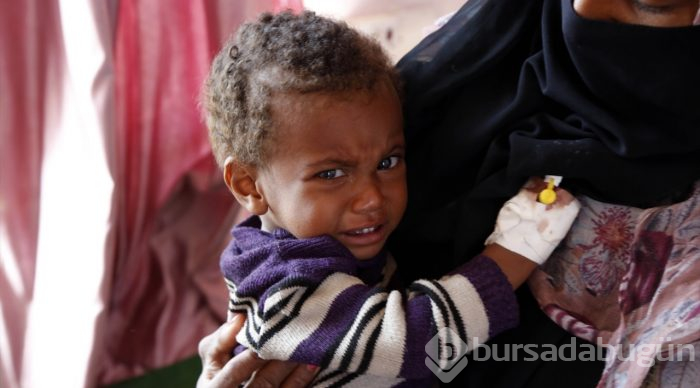 Yemen'de kıtlık en çok çocukları etkiliyor
