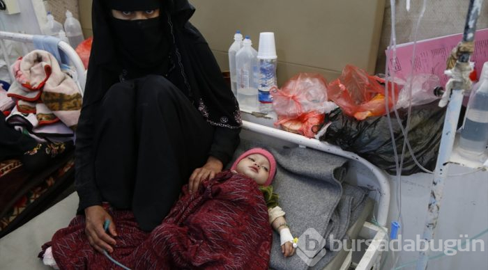 Yemen'de kıtlık en çok çocukları etkiliyor
