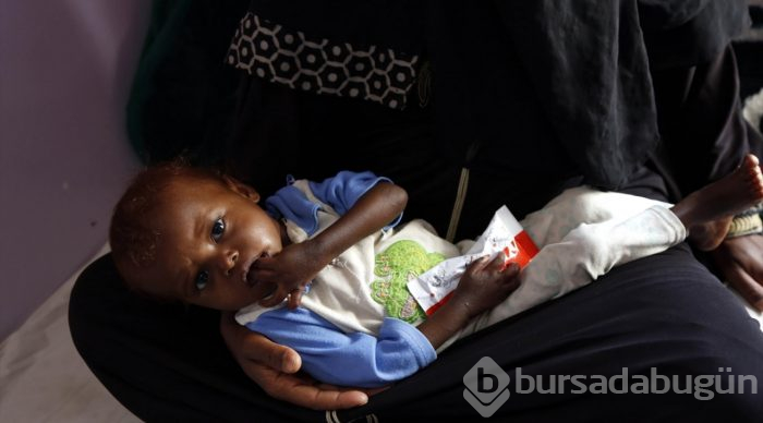 Yemen'de kıtlık en çok çocukları etkiliyor
