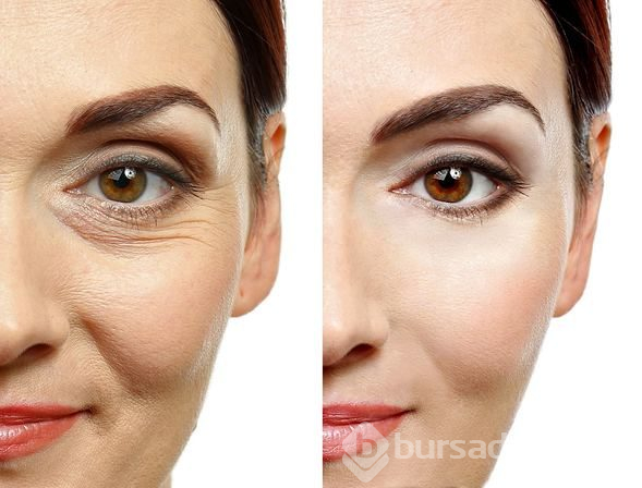 Mucize bitki aloe vera her derde deva oluyor
