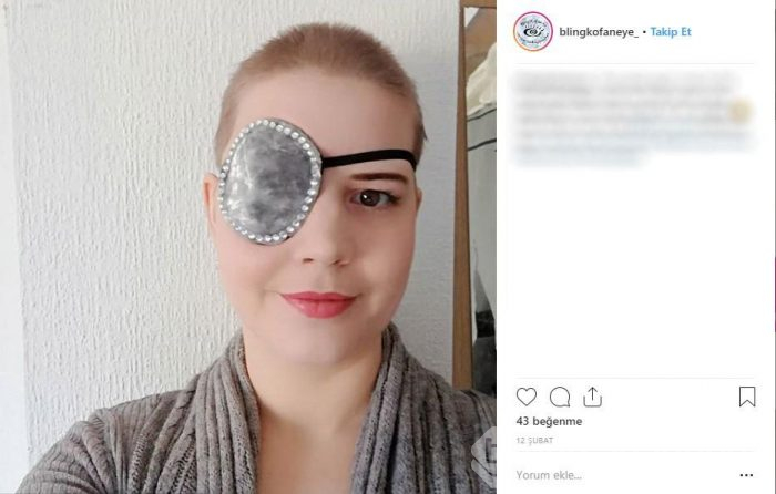 İngiltere onu konuşuyor: Gözünü aldırınca...
