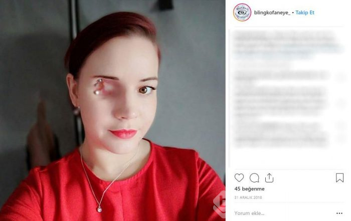 İngiltere onu konuşuyor: Gözünü aldırınca...
