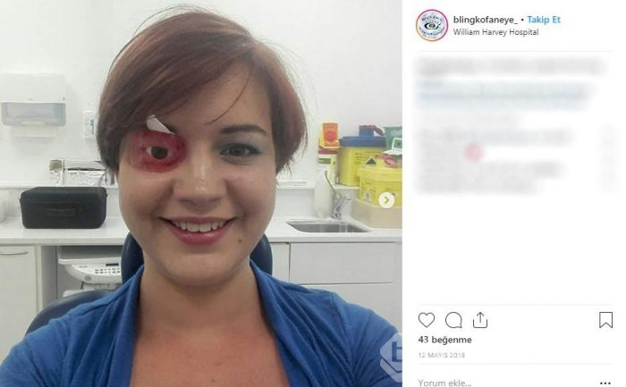 İngiltere onu konuşuyor: Gözünü aldırınca...
