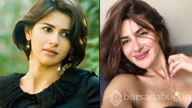 Nesrin Cavadzade'den estetik iddialarına ilginç yanıt!

