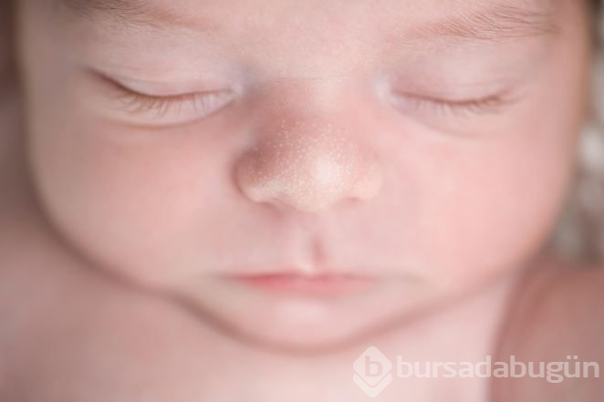 Kış aylarında bebeklerin cildini böyle koruyun
