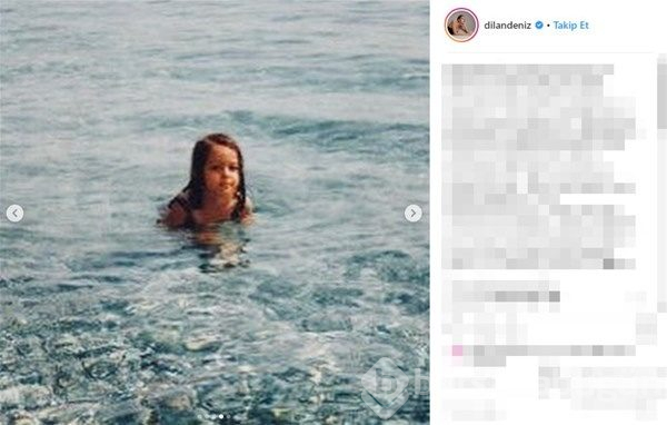 Dilan Çiçek Deniz'in çocukluk fotoğrafları olay oldu!

