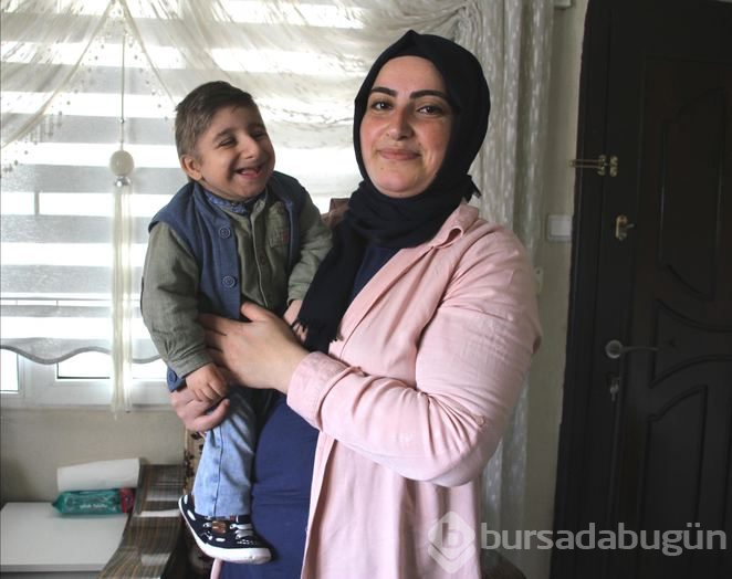 Hastalığa anne karnında yakalandı! Boyu sadece 70 santimetre

