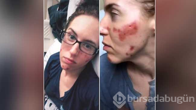 Restoranda elini yıkadı, bakteri kaptı
