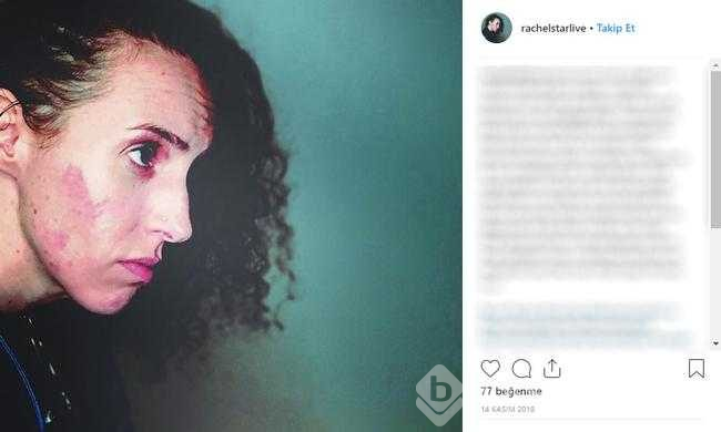 Restoranda elini yıkadı, bakteri kaptı
