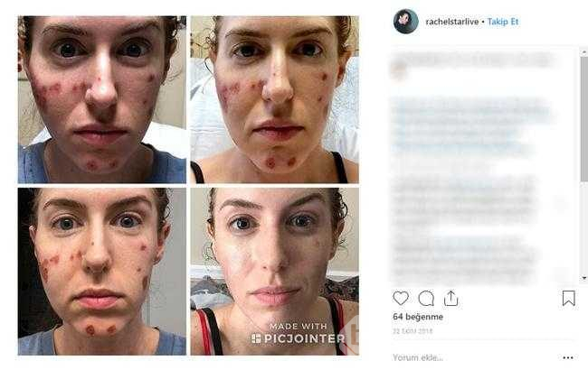 Restoranda elini yıkadı, bakteri kaptı
