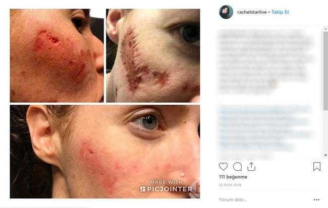 Restoranda elini yıkadı, bakteri kaptı
