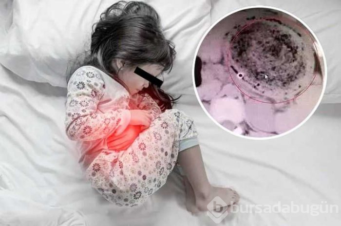 Karın ağrısıyla hastaneye kaldırıldı midesinden çıkanlar şoke etti
