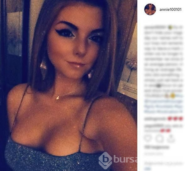 Anoreksiya hastalığına yakalanmıştı, şimdi ise bambaşka biri!
