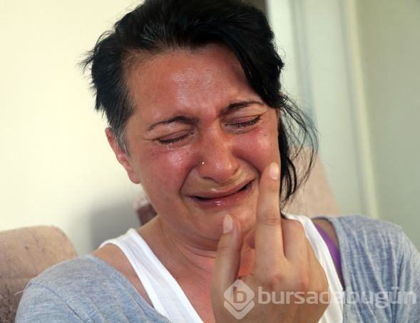 Aynaya baktığında ölmek istiyordu! Bir de şimdi görün...
